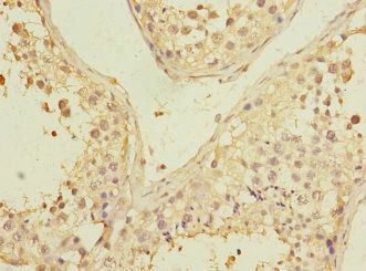PGAM2 Antibody
