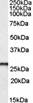 Goat anti-PGAM1 / PGAM2 / PGAM4 Antibody
