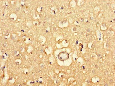 PGAP2 Antibody