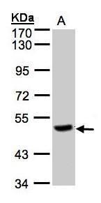 carboxypeptidase Q Antibody