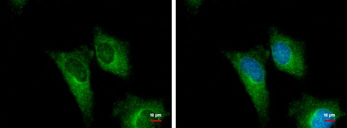 PGD antibody [N1N3]