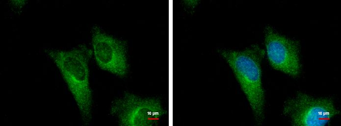 PGD antibody