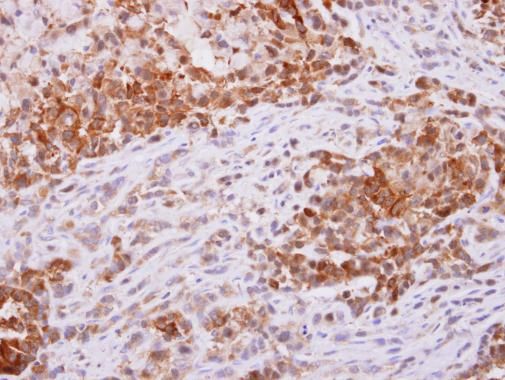 PGD antibody [N1N3]