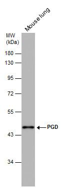 PGD antibody [N1N3]
