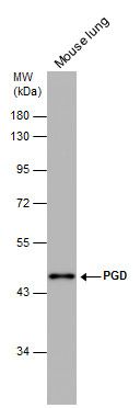 PGD antibody