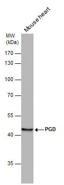 PGD antibody [N1N3]