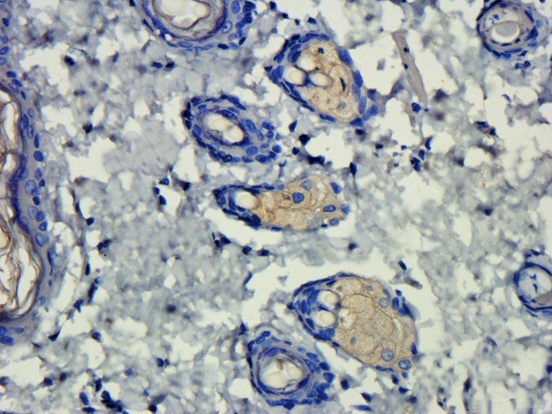 Prostaglandin E synthase 2 antibody