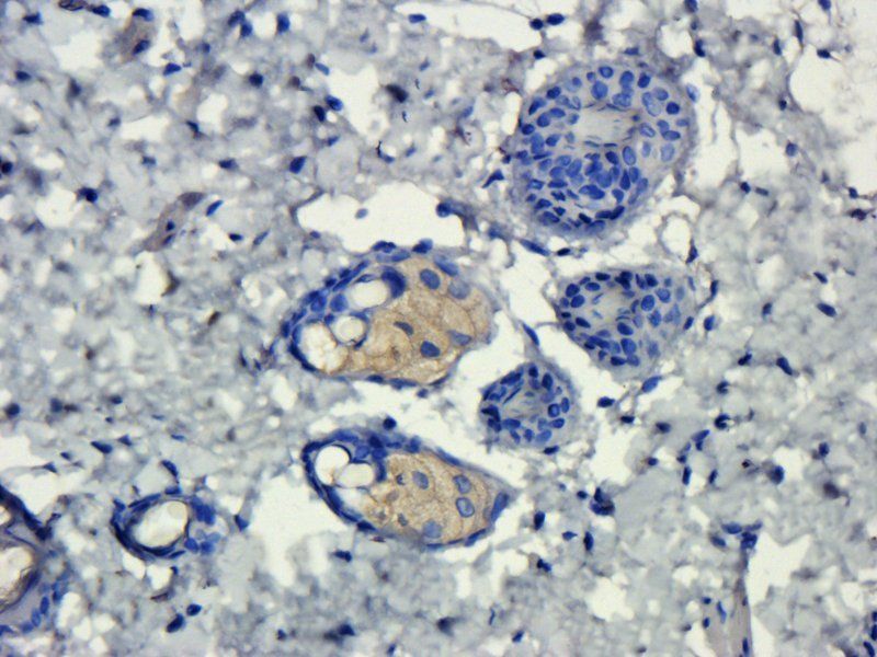 Prostaglandin E synthase 2 antibody