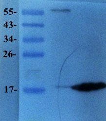 Prostaglandin E synthase 2 antibody