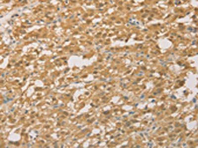 PGK2 Antibody