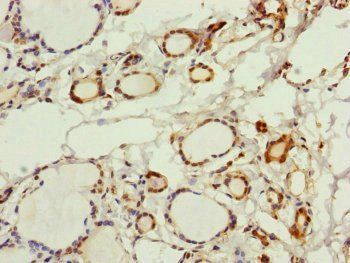 PGLS Antibody