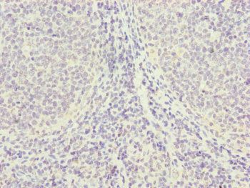 PGLS Antibody