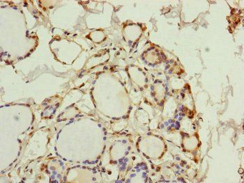 PGLS Antibody