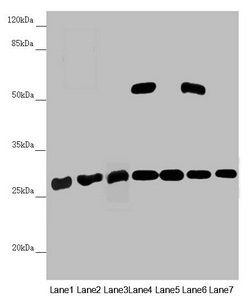 PGLS Antibody
