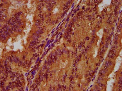 PGLYRP1 Antibody