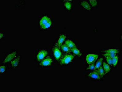PGM1 Antibody