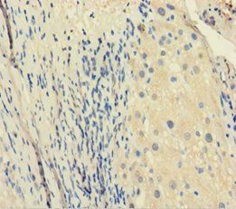 PGM1 Antibody