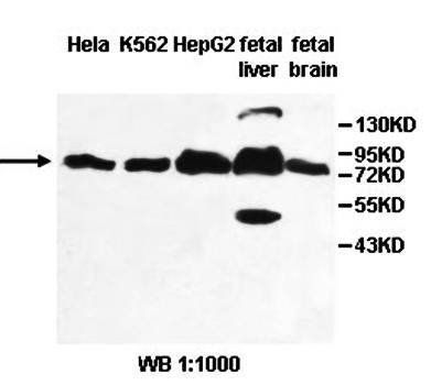 PGM2 Rabbit Polyclonal Antibody