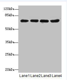 PGM2L1 antibody