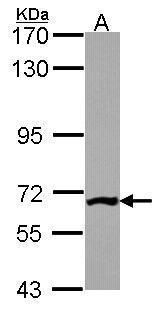 PGM3 antibody [N1C1]