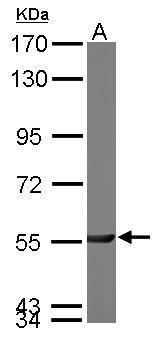 PGM3 antibody [N1C1]