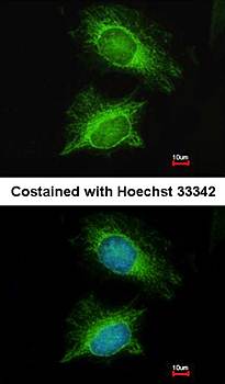 PGM3 antibody