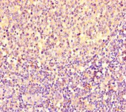 PGP Antibody
