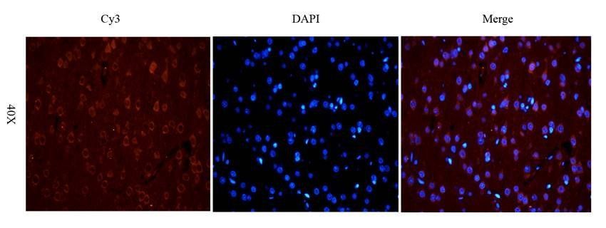 PGP9.5 antibody