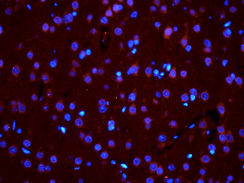 PGP9.5 antibody