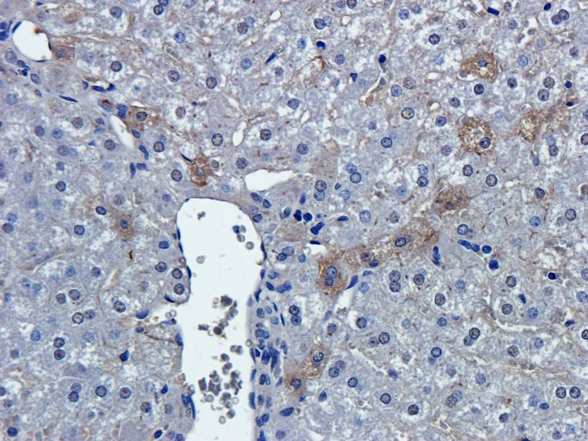 PGP9.5 antibody