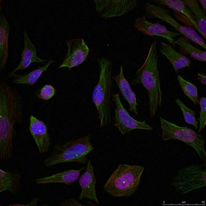 PGR Antibody