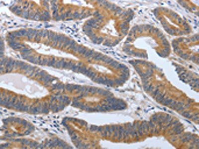 PGR Antibody