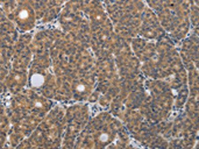PGR Antibody