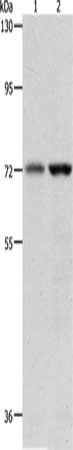 PGR Antibody
