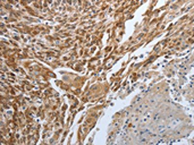 PGR Antibody
