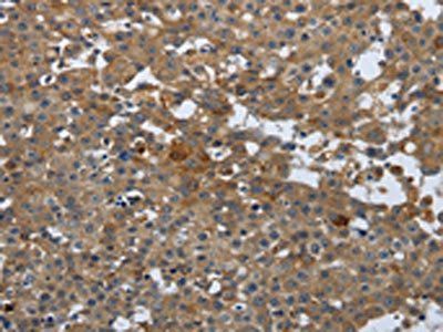 PGR Antibody