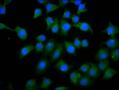 PHACTR1 Antibody