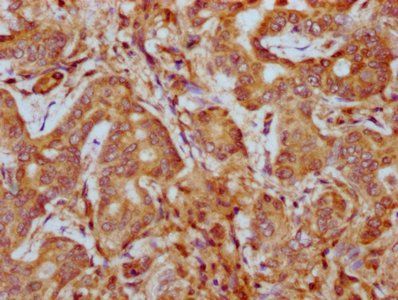 PHACTR1 Antibody