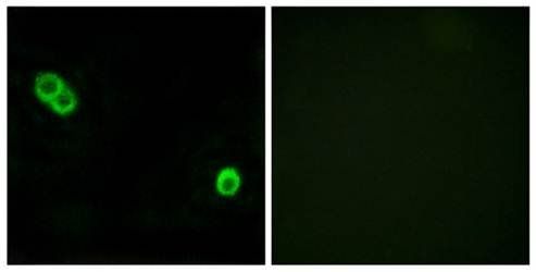 PHCA Antibody
