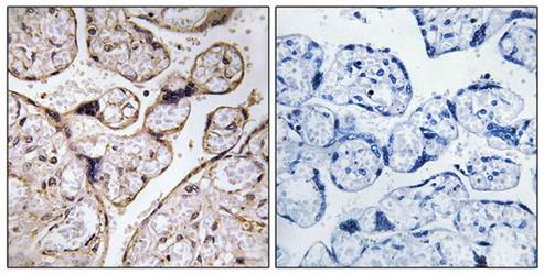 PHCA Antibody