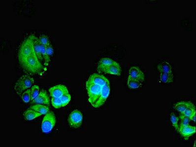 Phenylalanine-tRNA ligase alpha subunit antibody