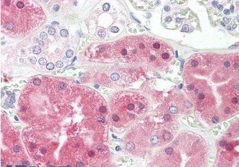 Goat anti-Phenylalanine Hydroxylase Antibody