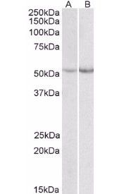 Goat anti-Phenylalanine Hydroxylase Antibody