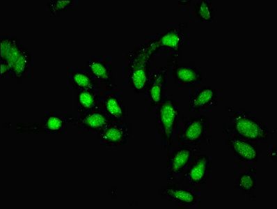 PHF10 antibody