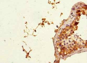 PHF11 Antibody