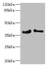 PHF11 antibody