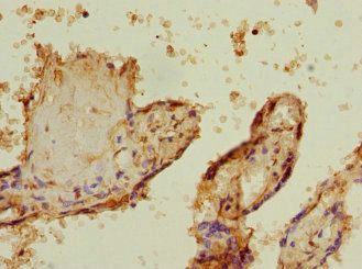 PHF11 Antibody