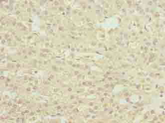 PHF13 Antibody