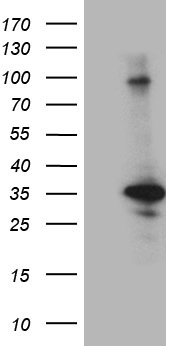 PHF20L1 Antibody