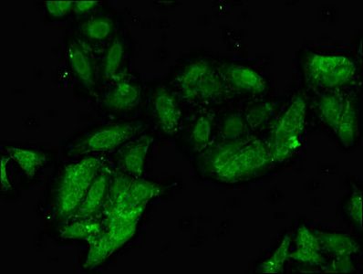 PHF21A Antibody
